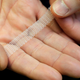 Image for article titled The FDA Has Finally Stopped the Sale of Pelvic Mesh